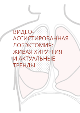 Результаты образовательного вебинара «Видео-ассистированная лобэктомия: живая хирургия и актуальные тренды»