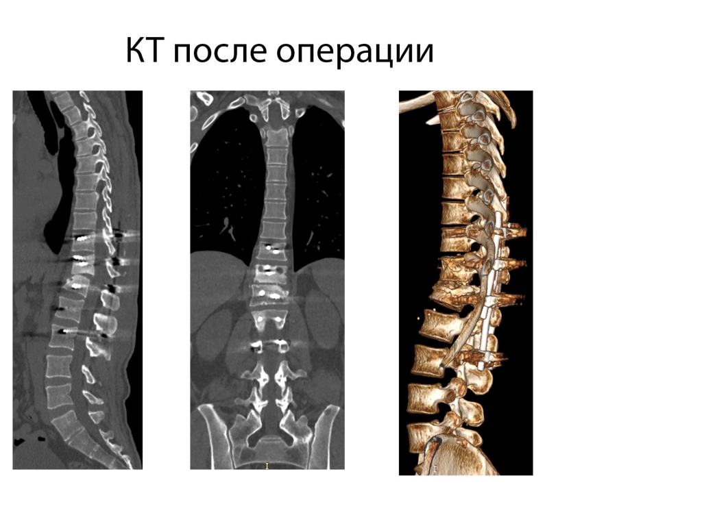 После операции.jpg